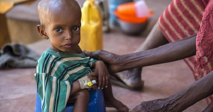Somali’de gıda sıkıntısı 500 bin çocuğu ölüm riskiyle karşı karşıya bırakıyor..