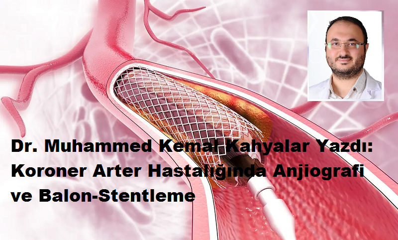 Dr. Muhammed Kemal Kahyalar Yazdı: Koroner Arter Hastalığında Anjiografi ve Balon-Stentleme